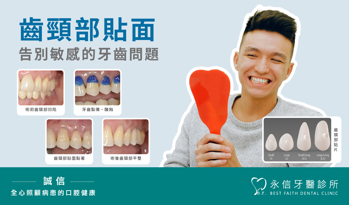 齒頸部貼片，告別敏感的牙齒問題